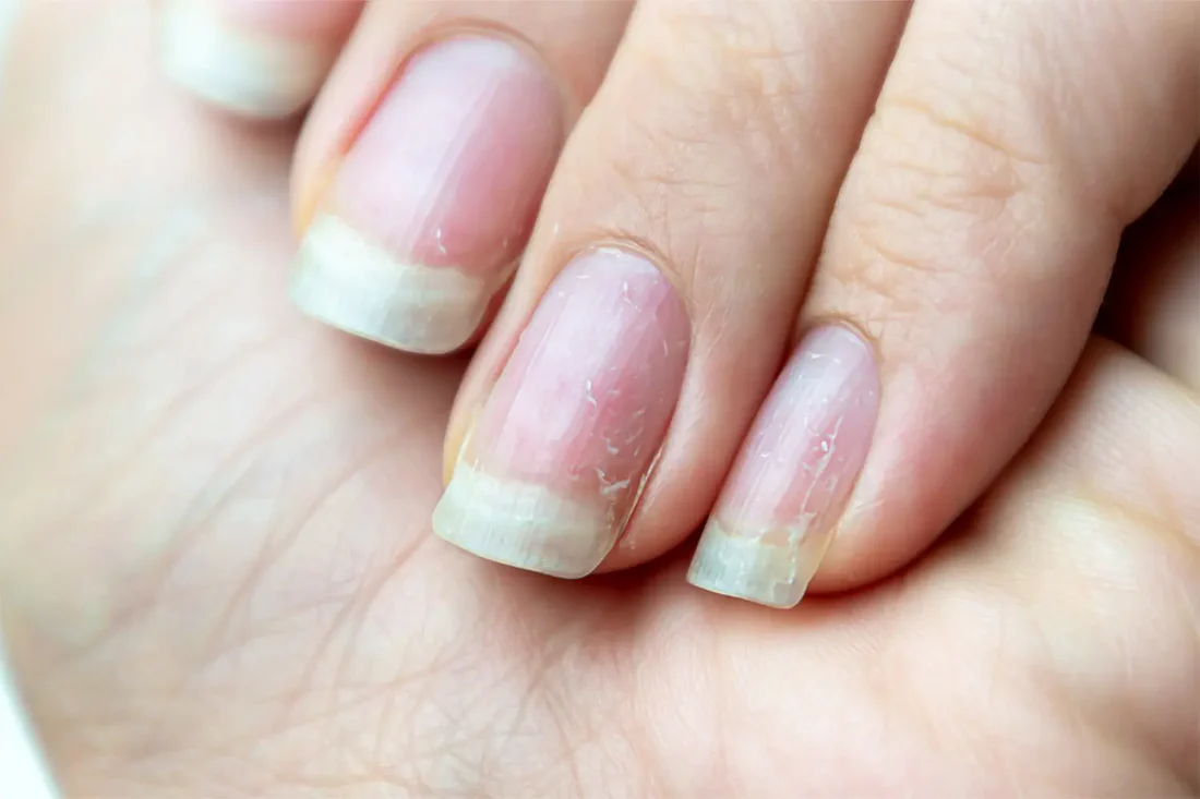 How to strengthen weak nails naturally