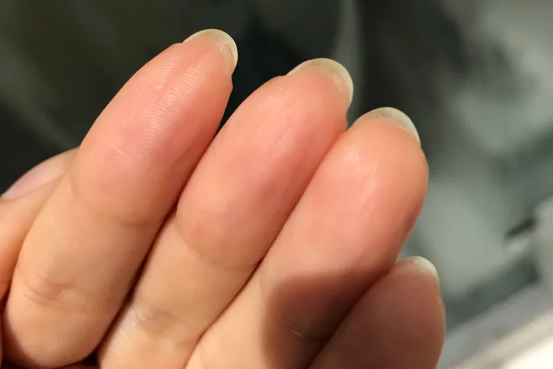 why my nails grow slowly