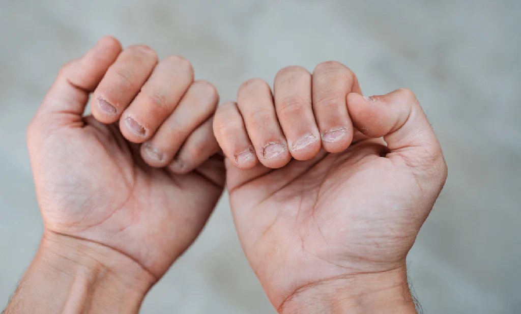 how to fix brittle nails naturally.