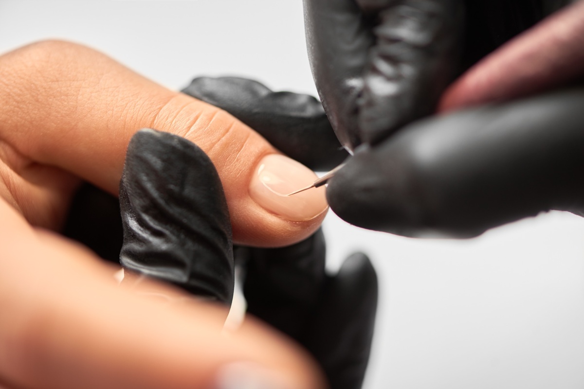 how to prevent nail damage