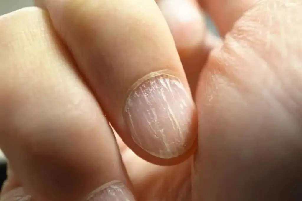 how to heal cracked nails naturally